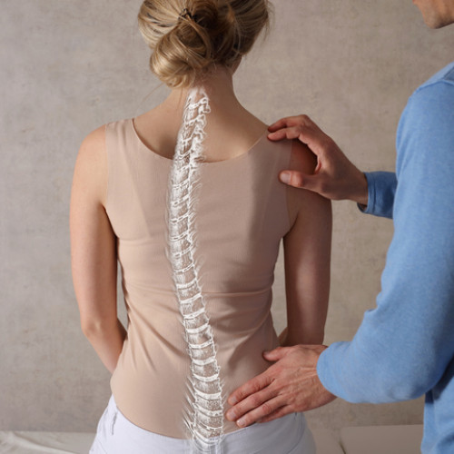 Scoliosis